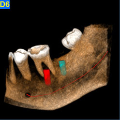 cbct img