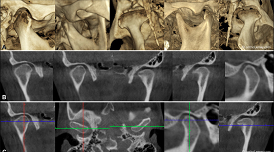 TMJ (Jaw Joint) Imaging